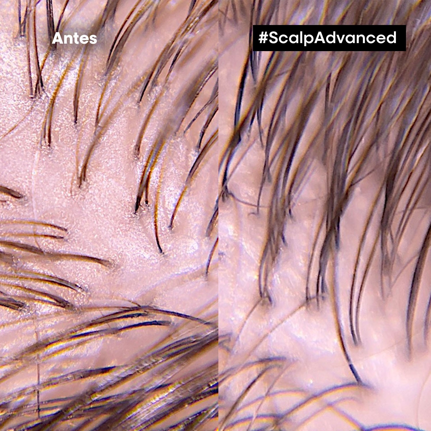 SCALP SHAMPOO ANTI-SENSIBILIDAD (SHAMPOO PARA CUERO CABELLUDO SENSIBLE)